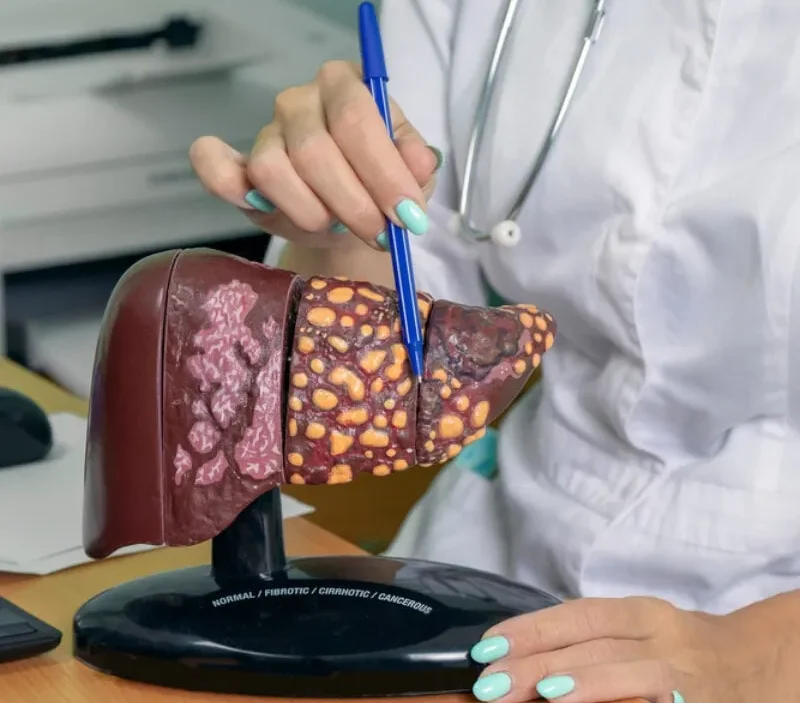 Doctor explaining liver disease using anatomical model