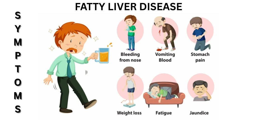 Symptoms of Fatty Liver Disease
