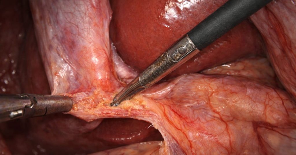 Liver Care Center – Dr. Muhammad Zakria (Liver Specialist in Lahore)