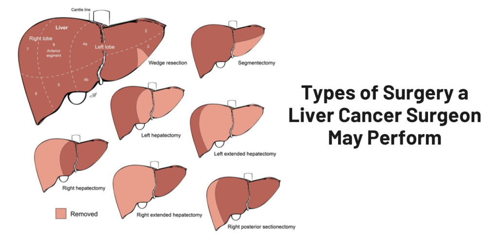 Liver Care Center – Dr. Muhammad Zakria (Liver Specialist in Lahore) Liver Care Center – Dr. Muhammad Zakria (Liver Specialist in Lahore)