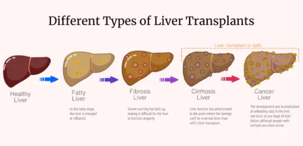 Liver Care Center – Dr. Muhammad Zakria (Liver Specialist in Lahore)