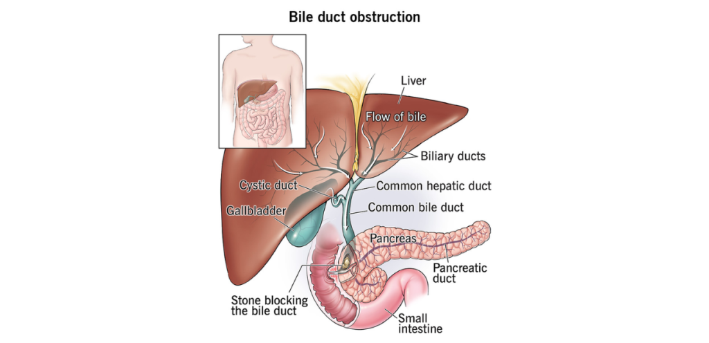 Liver Care Center – Dr. Muhammad Zakria (Liver Specialist in Lahore) Liver Care Center – Dr. Muhammad Zakria (Liver Specialist in Lahore)
