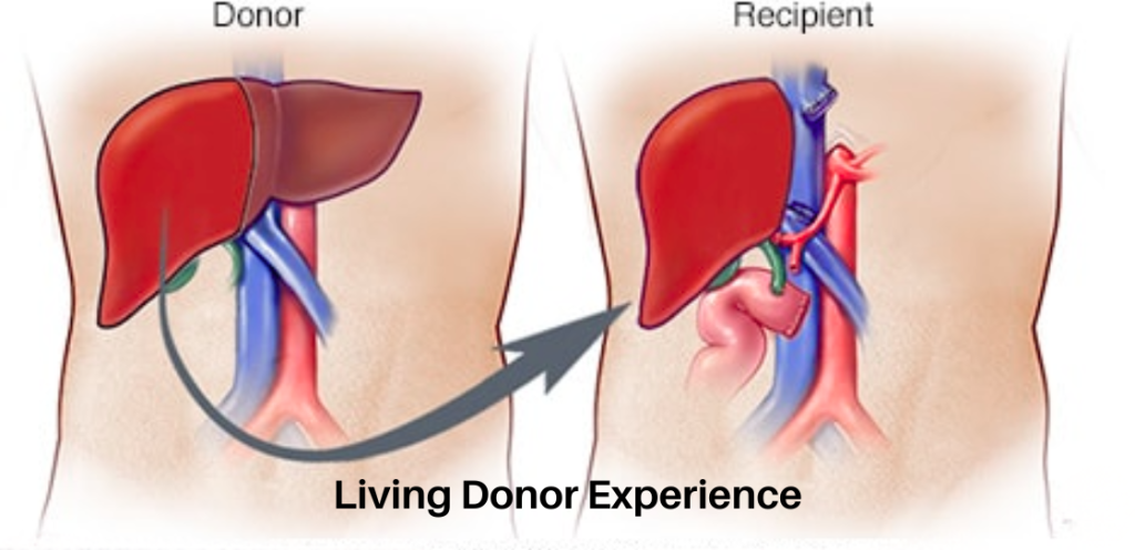 Liver Care Center – Dr. Muhammad Zakria (Liver Specialist in Lahore)