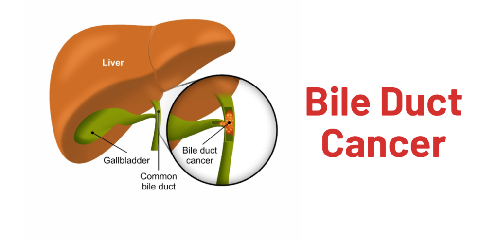 Liver Care Center – Dr. Muhammad Zakria (Liver Specialist in Lahore) Liver Care Center – Dr. Muhammad Zakria (Liver Specialist in Lahore)