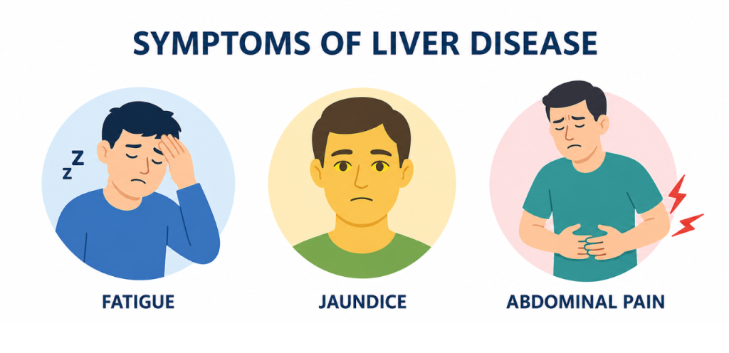 symptoms of liver disease like jaundice fatigue pain