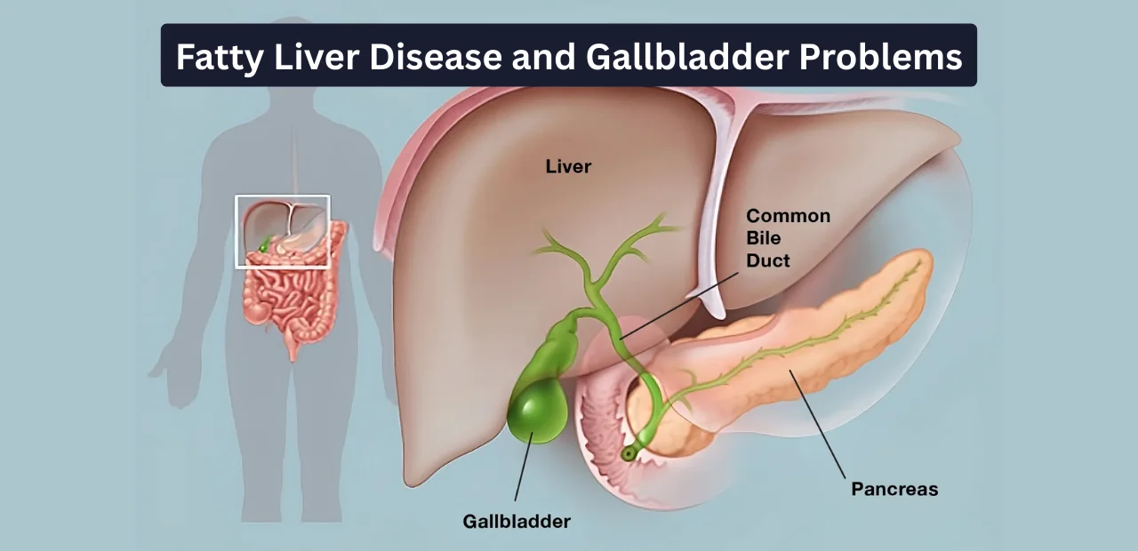 Fatty Liver Disease & Gallbladder Problems