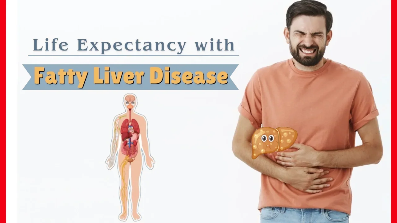 Life Expectancy With Fatty Liver Disease