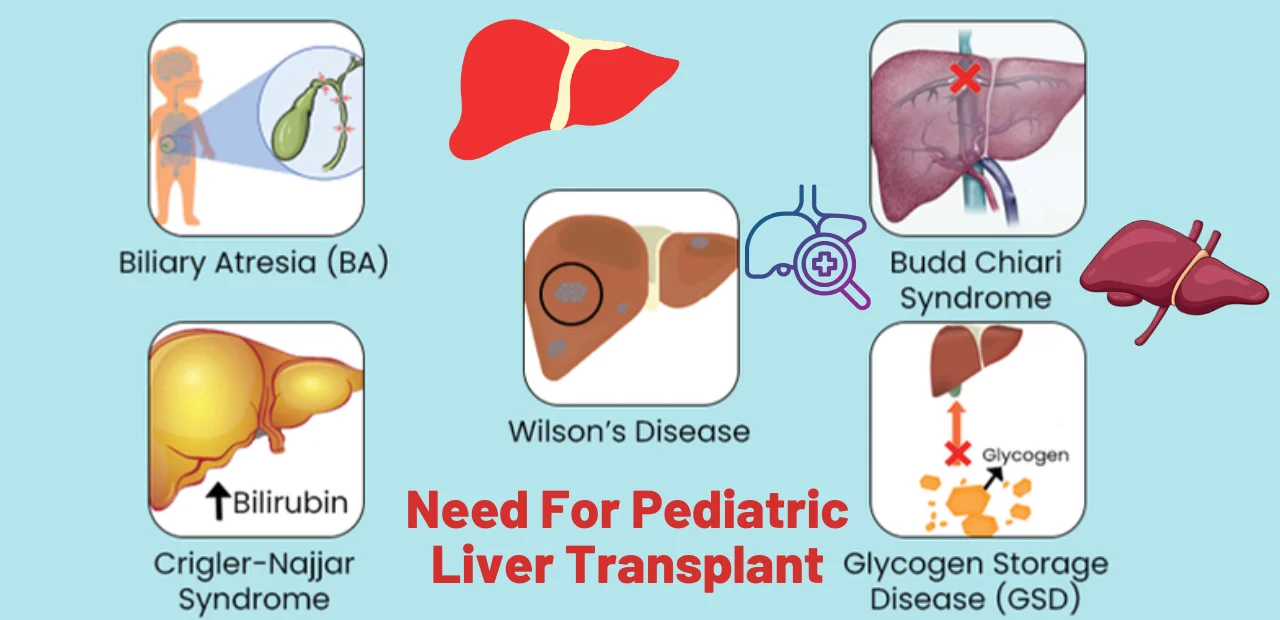 Pediatric Liver Transplant Surgeon