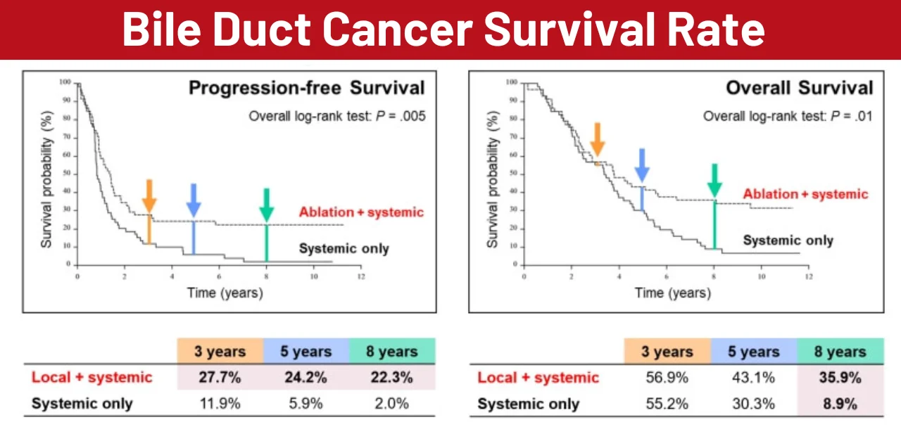 Bile Duct Cancer Survival Rate