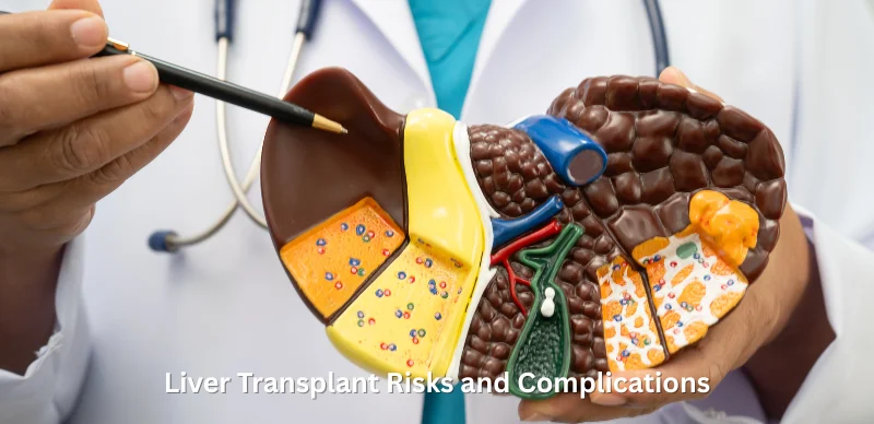 Liver Transplant Risks and Complications