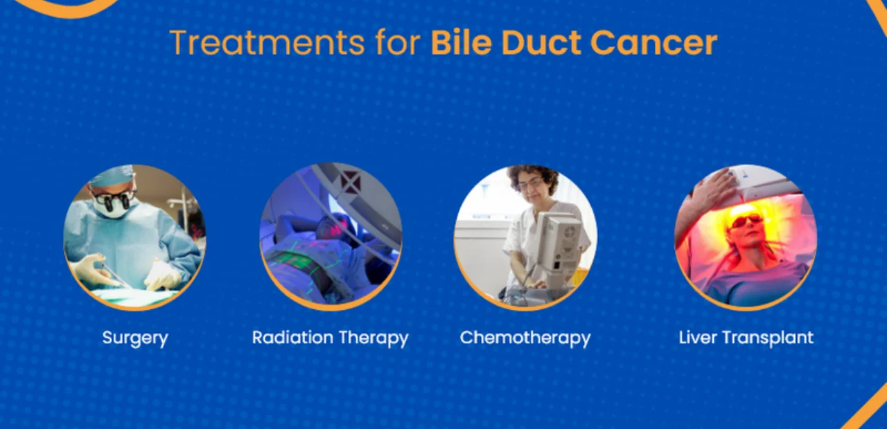 Liver Care Center – Dr. Muhammad Zakria (Liver Specialist in Lahore) Treatment Options for Bile Duct Cancer