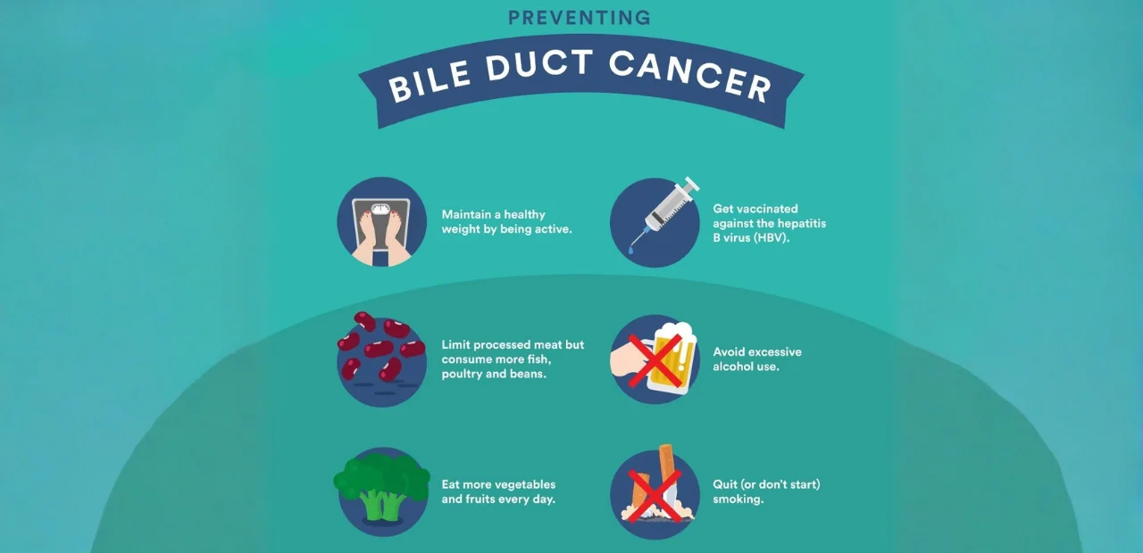 Can Bile Duct Cancer Be Prevented